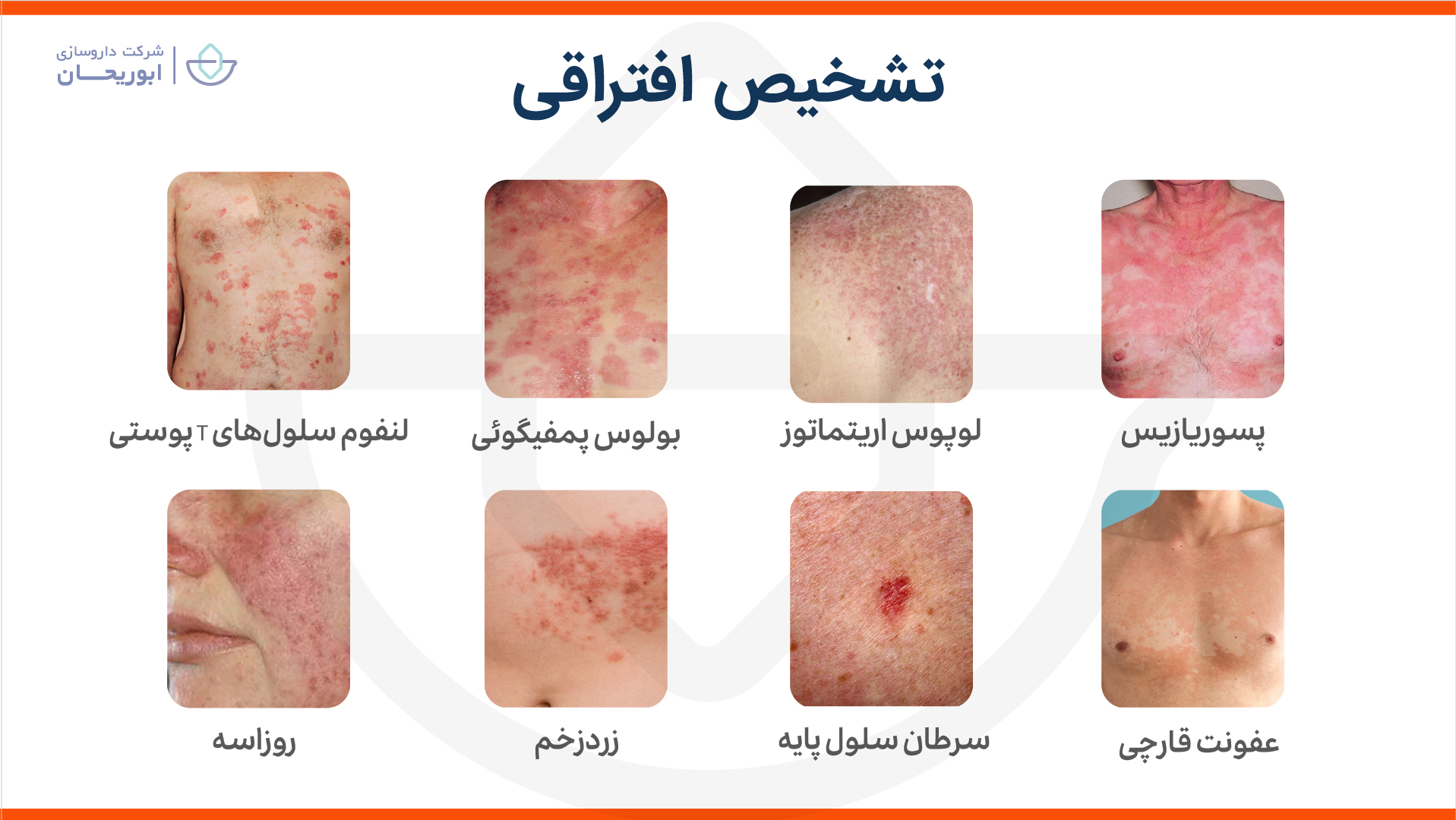 تشخیص افتراقی درماتیت