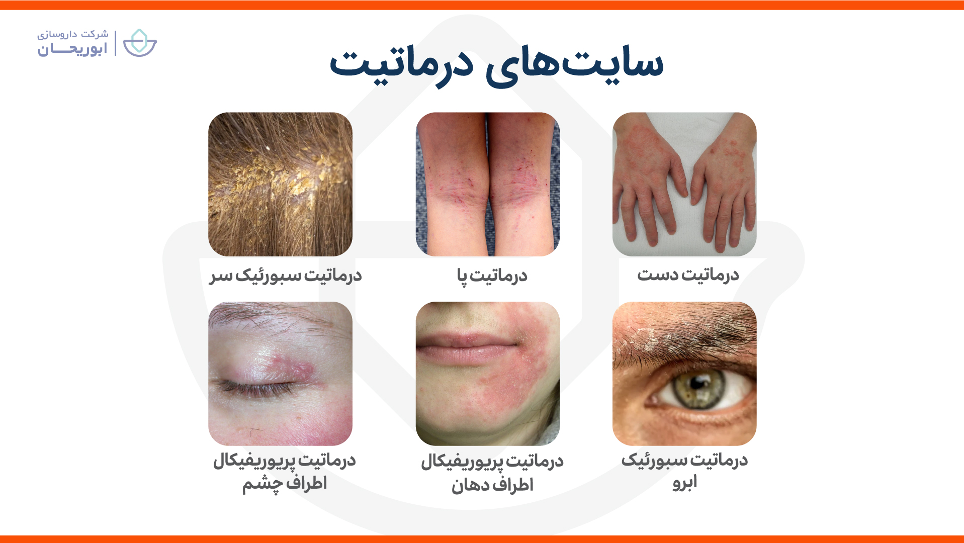 محل درماتیت