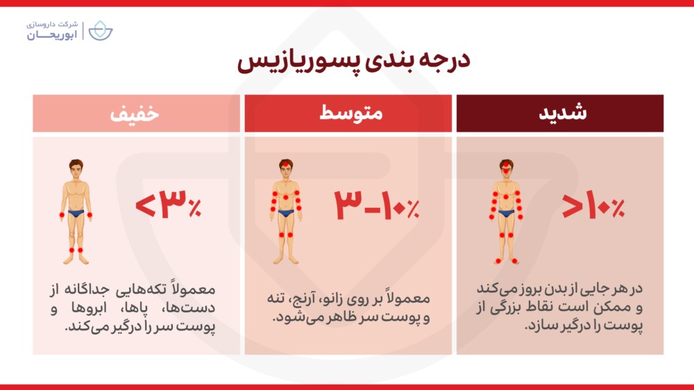 درجه پسوریازیس