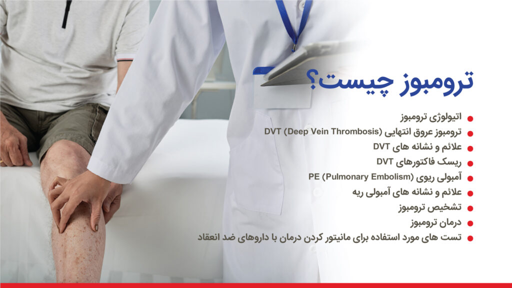 ترومبوز