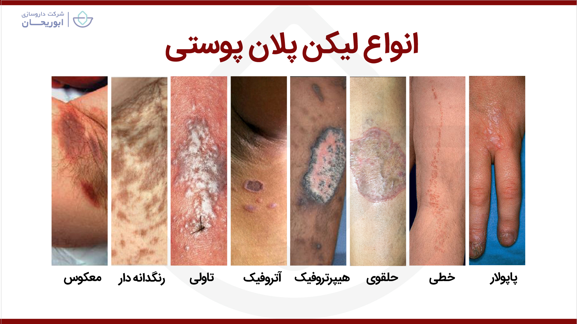 انواع لیکن پلان