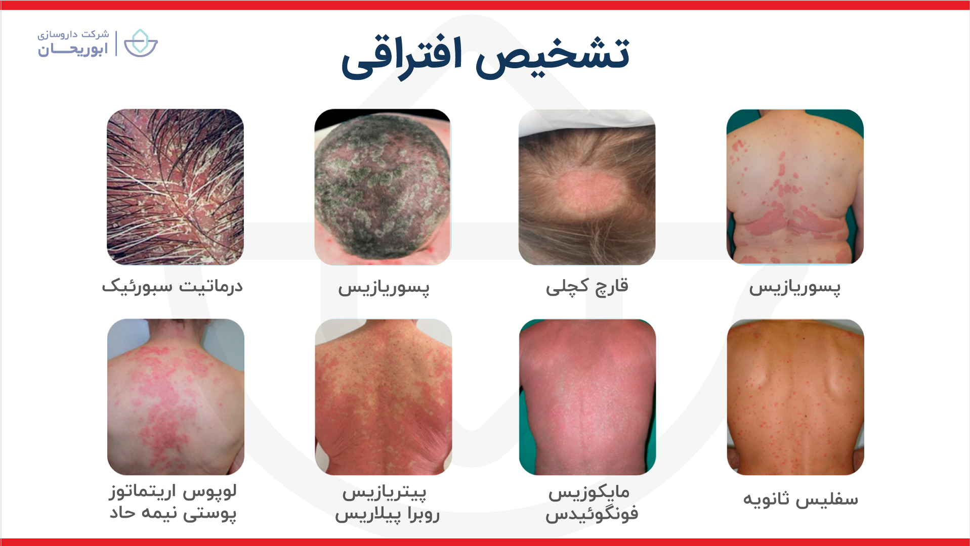 تشخیص افتراقی