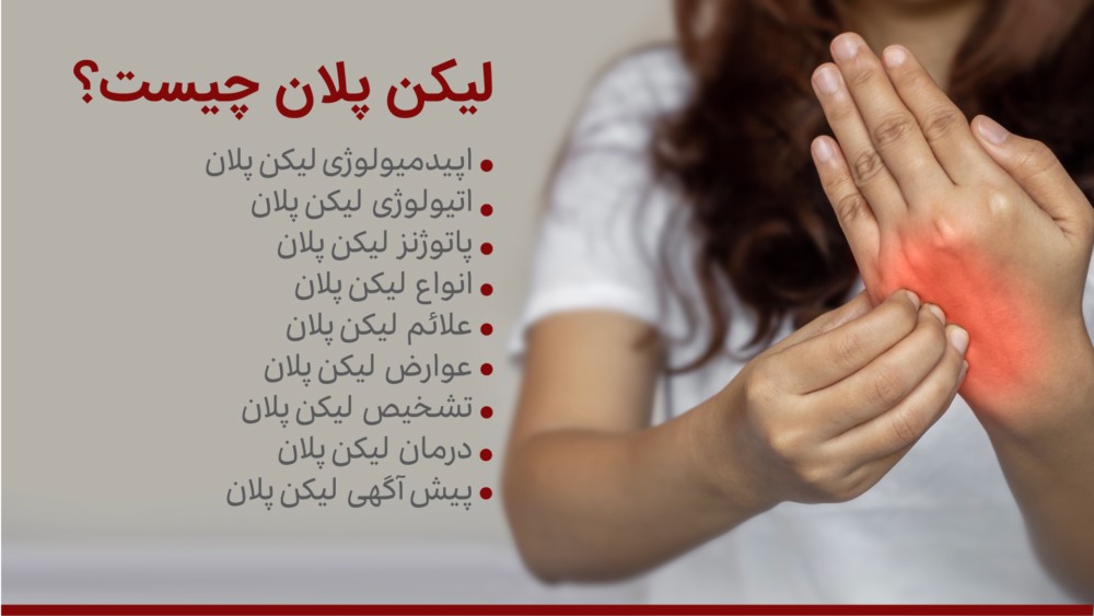 لیکن پلان