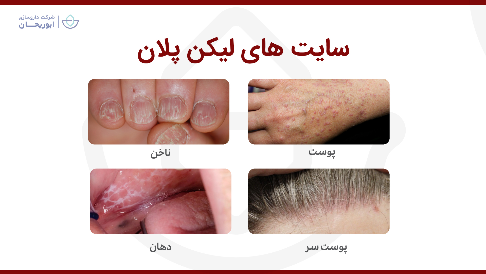 سایت لیکن پلان