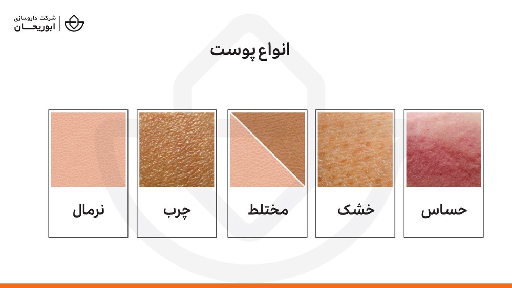 انواع پوست