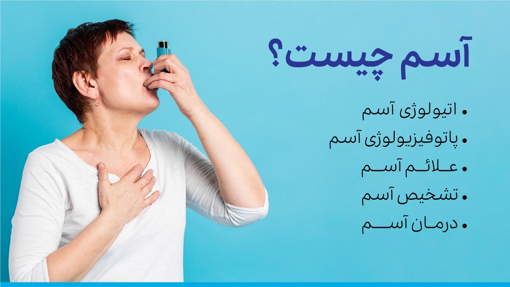 آسم چیست