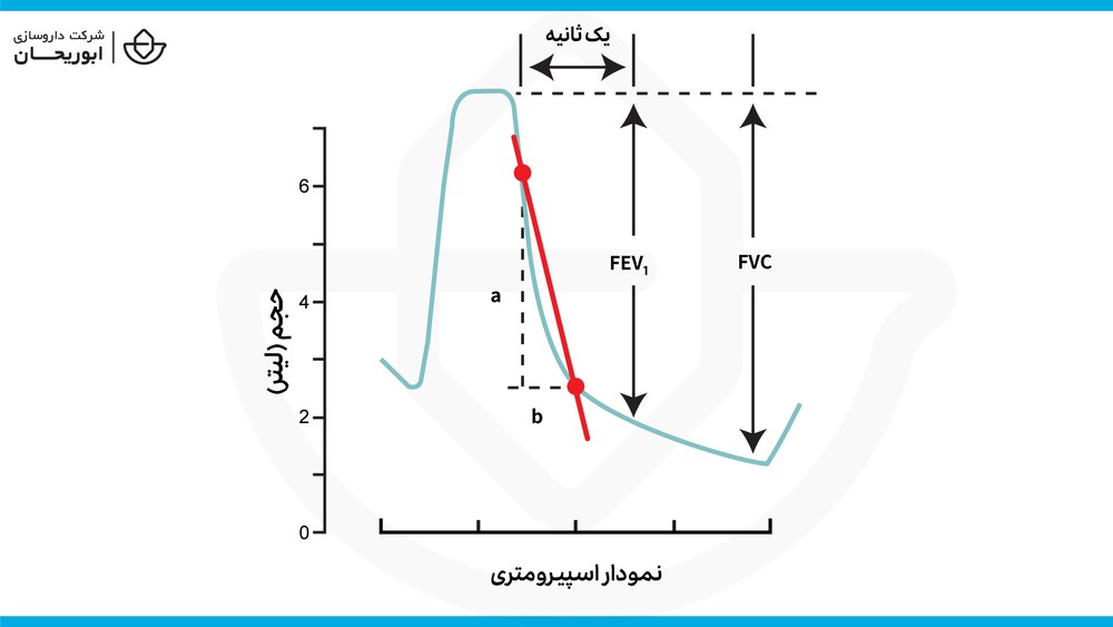 اسپیرومتری آسم